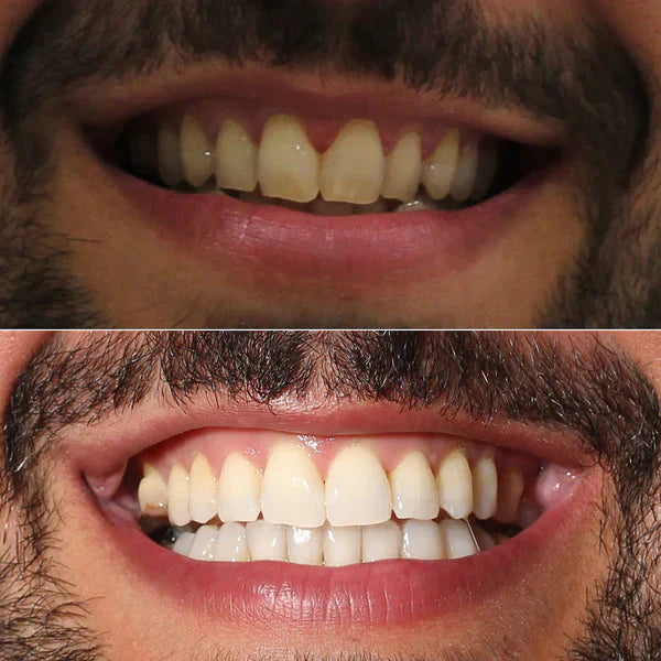 AquaSmile V34 Advanced Clinical Formula